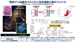 膀胱がんで免疫細胞が集まる腫瘍内環境の特徴を解明